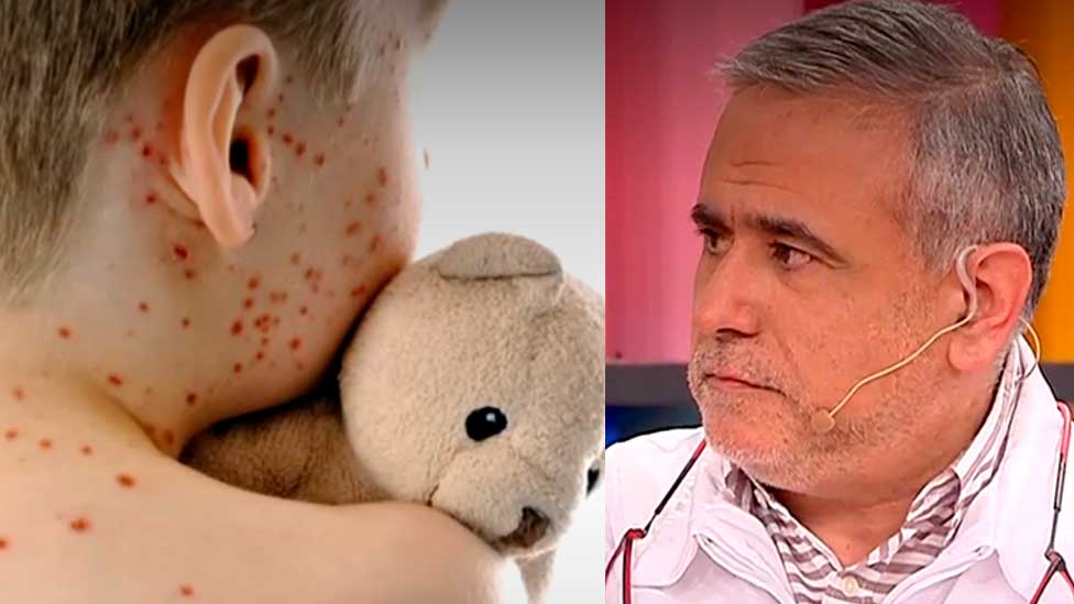 ¿Quienes deben vacunarse contra el sarampión?
