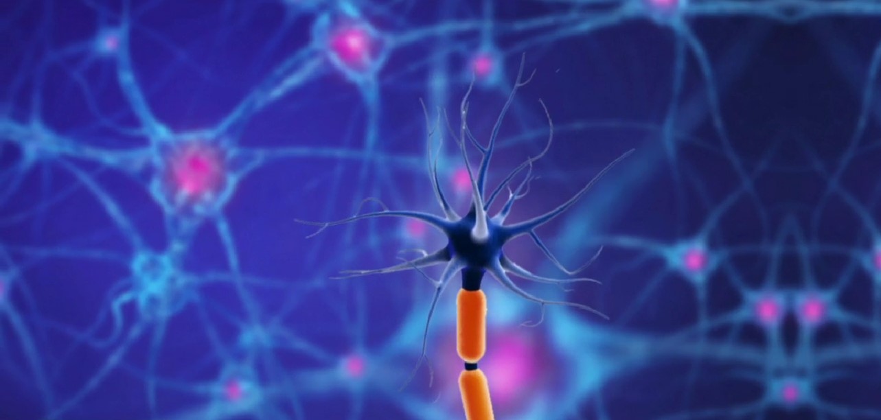 Parkinson: una rápida y dolorosa enfermedad que no tiene cura
