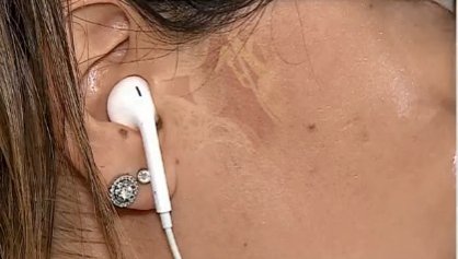 Los riesgos a la salud al usar audífonos a todo volumen
