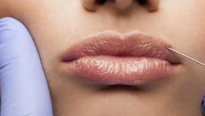 ¿En qué debo fijarme si quiero hacerme una cirugía estética?
