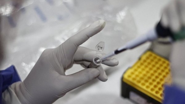 Ministerio de Salud confirma segunda muerte por Viruela del Mono en Chile
