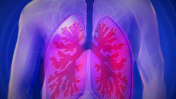 Cáncer de pulmón: ¿cuáles son sus síntomas y cómo prevenir la enfermedad?
