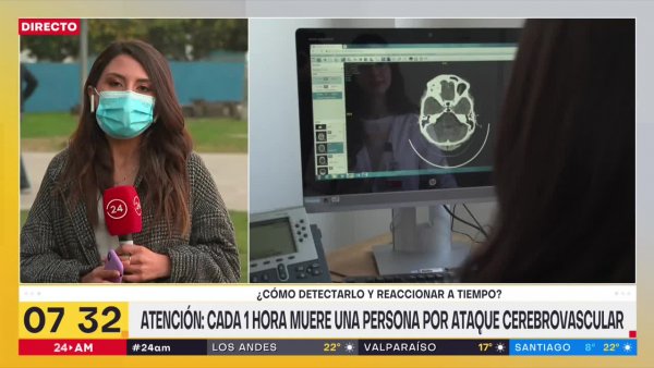 Accidente Cerebro Vascular: los 3 síntomas claves para detectar a tiempo un ACV
