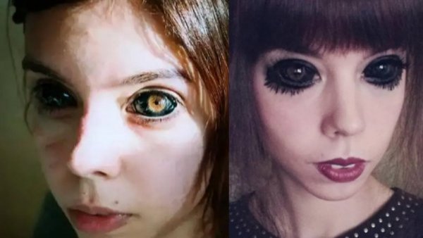 Joven queda ciega tras tatuarse los ojos para parecerse a su ídolo rapero

