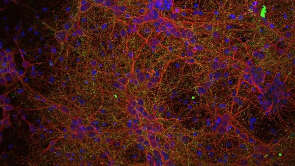 La ciencia abre una prometedora vía para tratar lesiones medulares
