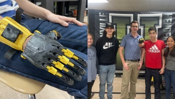 "Cambió mi vida": estudiantes construyeron mano robótica a compañero de clase
