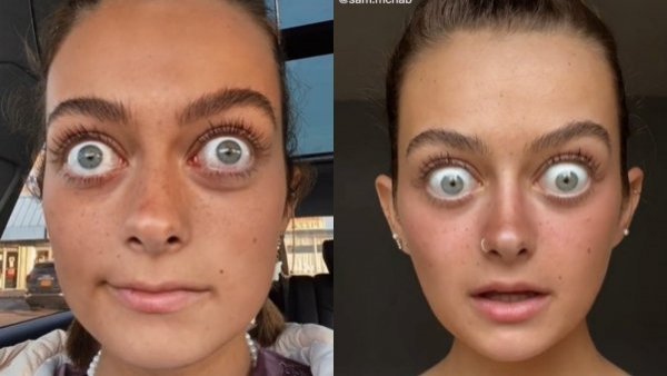 Mujer se viraliza en redes sociales por sus grandes ojos: "Me dicen Gollum"
