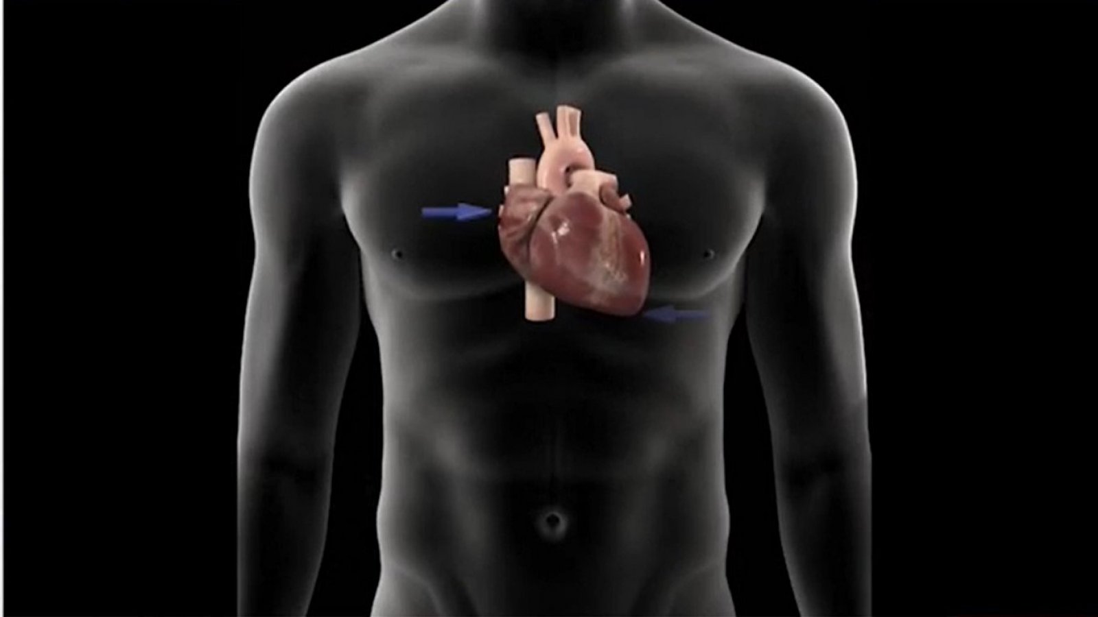 Hoy es el día mundial de la cardiopatía congénita
