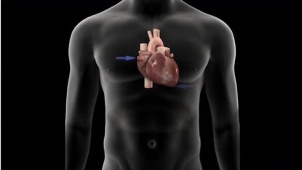 Hoy es el día mundial de la cardiopatía congénita

