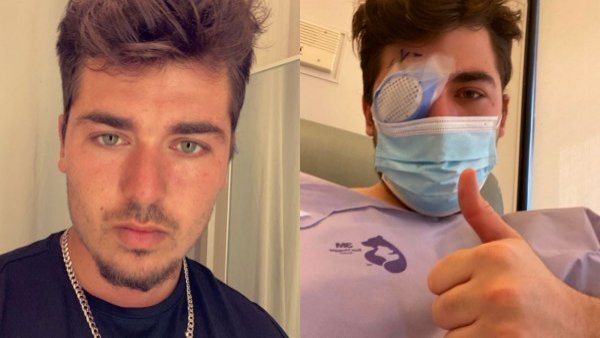 Joven narró en TikTok cómo perdió la visión tras una siesta con lentes de contacto puestos
