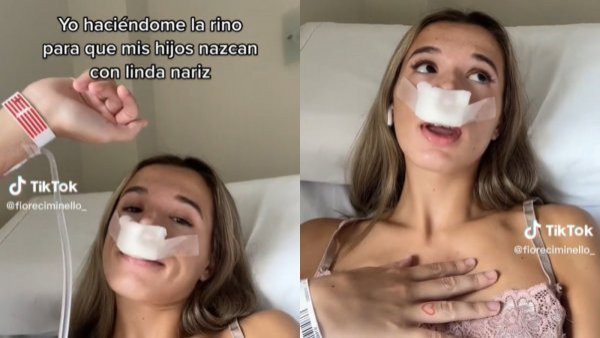 Por sus hijos: la insólita razón por la que una tiktoker se operó la nariz
