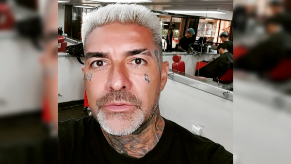 DJ Méndez impresiona a sus seguidores de Instagram con intervención estética
