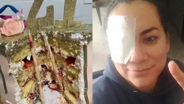 "Broma termina mal": mujer casi pierde su ojo tras popular "tortazo" en su cumpleaños
