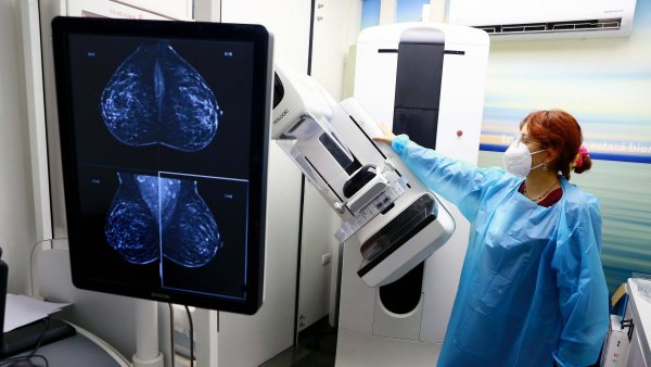 Mamografía: ¿Cuál es su importancia y qué necesitas saber para agendar la tuya?
