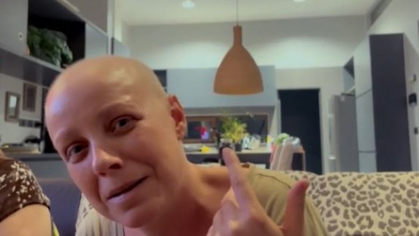 Le vuelve a crecer el pelo a Claudia Conserva
