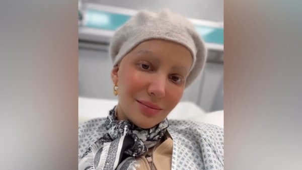 "Vi alambres salidos de mi pecho": Aylén Milla narra dolorosa cirugía tras 13 quimioterapias
