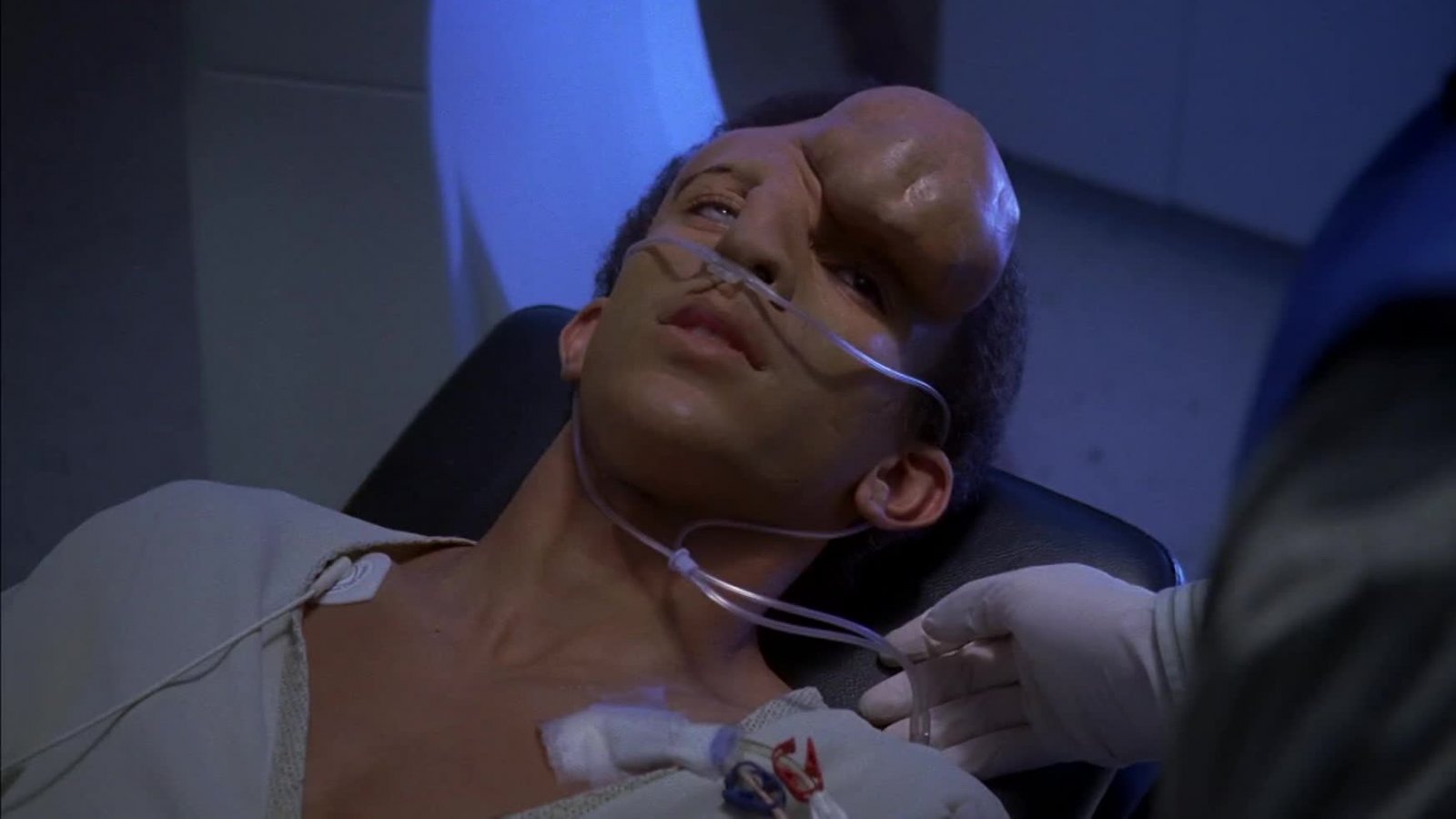 Dr. House Temporada 4 Capítulo 7: Feo
