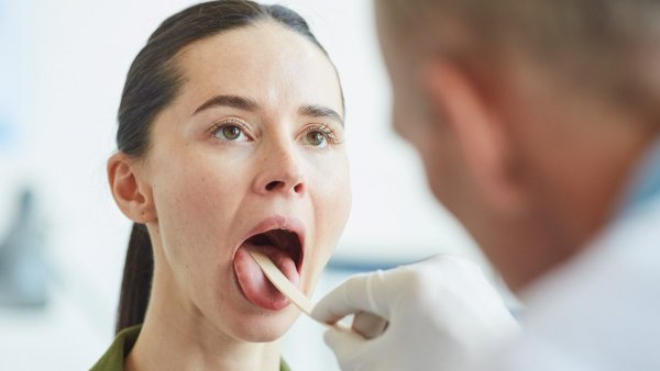 Siete señales de alerta para detectar el cáncer oral
