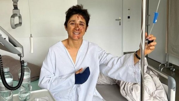 Bárbara Riveros: así fue su grave accidente
