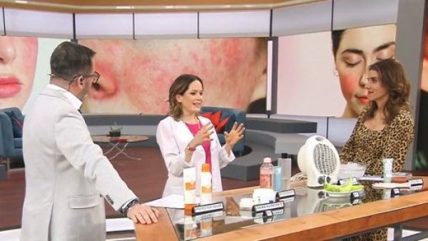 Síntomas y tratamiento: Todo lo que debes saber sobre la rosácea
