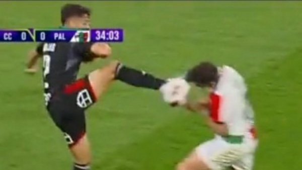 “Gajes del oficio”: Así quedó la cara de Fernando Meza tras la patada de Jeyson Rojas
