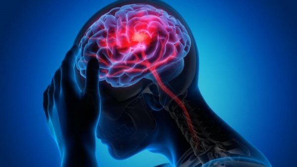 ¿Qué hacer frente a una crisis de epilepsia?
