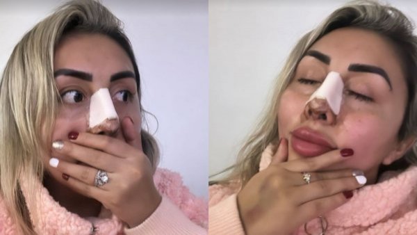 "Mi nuevo perfil": Naya Fácil sorprende con resultados tras cirugías estéticas