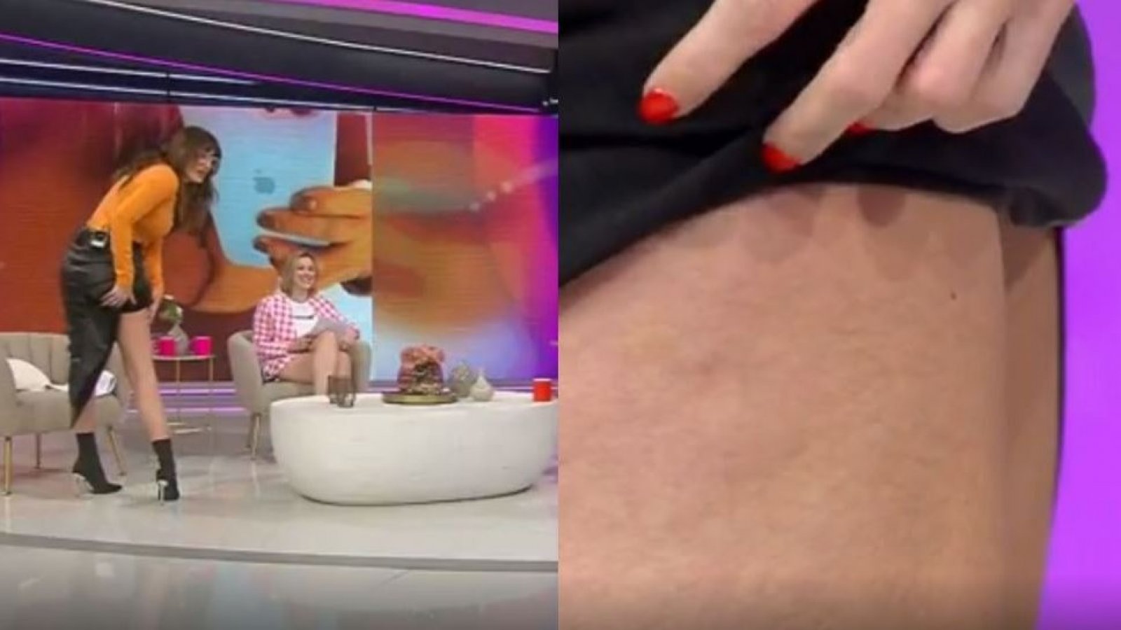 "Esto que tengo acá es celulitis": Yamila Reyna y el peso psicológico de la violencia estética
