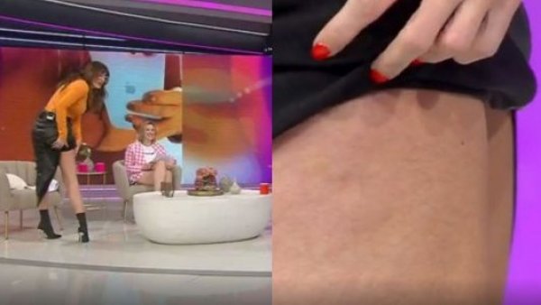 "Esto que tengo acá es celulitis": Yamila Reyna y el peso psicológico de la violencia estética
