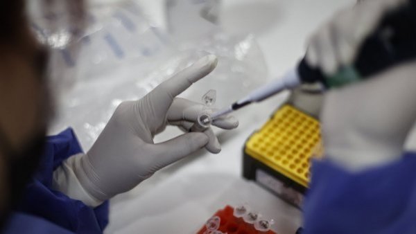 <p>ISP. medicamento. retiro.</p>Laboratorio Sanderson: ISP ordena retiro de productos fabricados antes de 13 de enero de 2023
