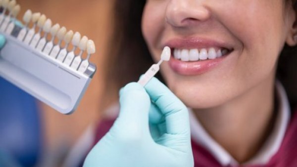 Blanqueamiento dental: los riesgos de hacerlo sin indicación médica
