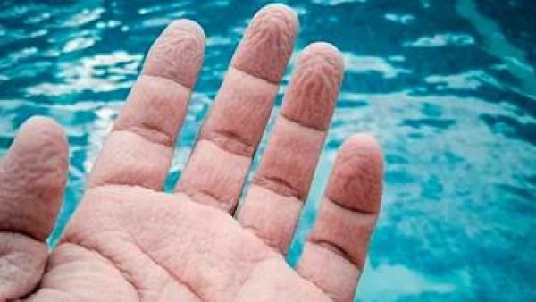 ¿Por qué se arrugan los dedos de las manos en el agua?