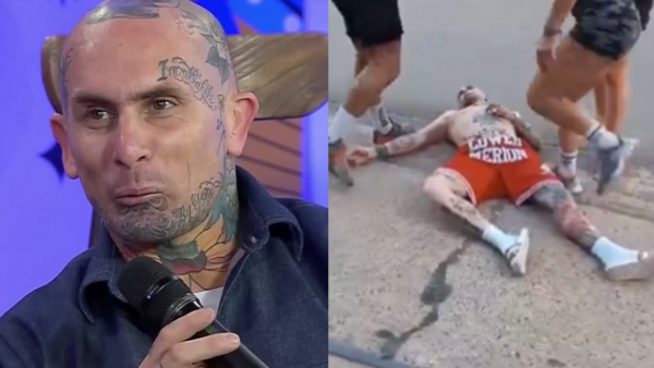 Los descargos de vocalista de Ke Personajes tras pelea que lo dejó KO