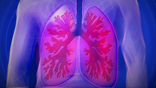 Cáncer de pulmón vuelve a ser el más común en el mundo y se mantiene como el más mortal
