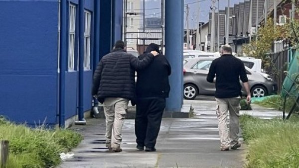 Mujer fue quemada por su pareja y tiene el 80% de su cuerpo dañado
