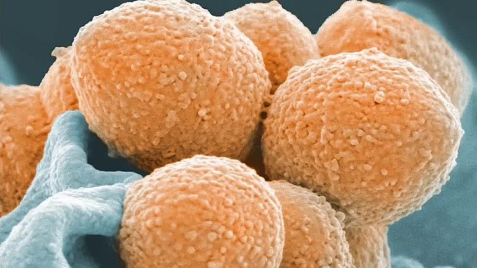 Streptococcus Pyogenes: ¿Qué es y por qué se le llama "bacteria asesina"?
