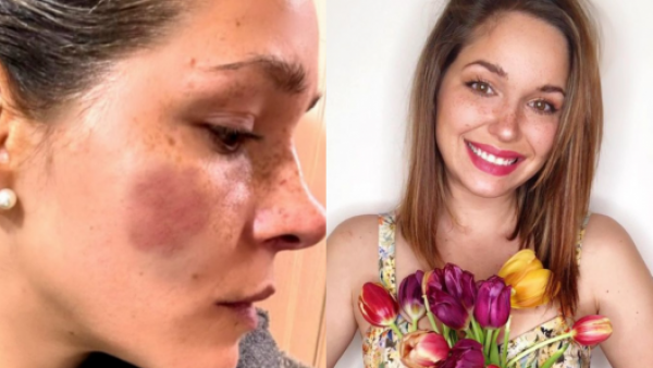 "Feliz día abusador": el duro mensaje de Nicole Block en el Día del Padre
