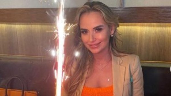 "Tenía unos pelones horribles”: exMekano narra su lucha contra la alopecia
