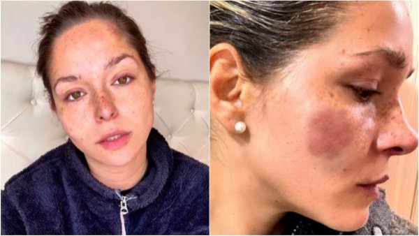 Nicole Block iniciará acciones legales en contra de su padre y exesposo