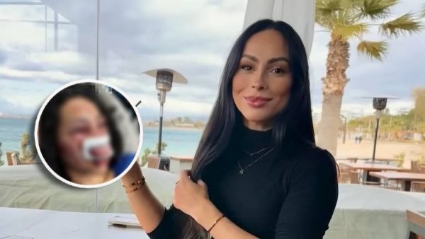 Ataque del Tren de Aragua o robo: las teorías del violento asalto a supuestas trabajadoras sexuales en Las Condes