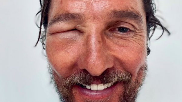 Matthew McConaughey alarmó a sus fans con una foto en redes sociales donde luce irreconocible

