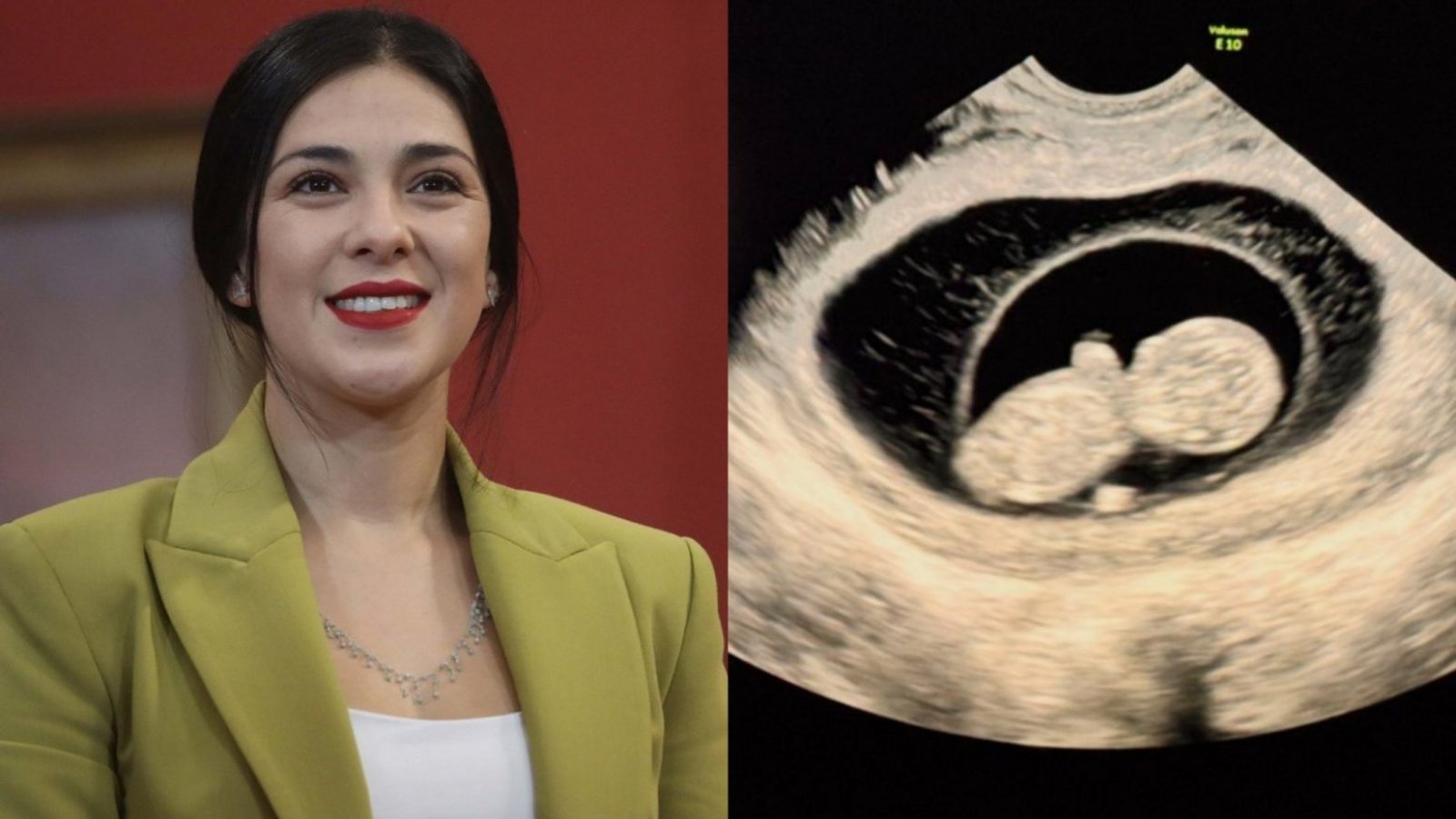 Karol Cariola. Embarazo. Ecografía.
