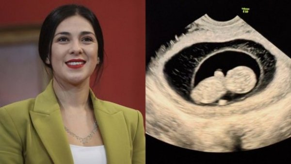 <p>Karol Cariola. Embarazo. Ecografía. </p>Karol Cariola y Tomás de Rementería anuncian que tendrán un bebé: "Estamos muy contentos y agradecidos"
