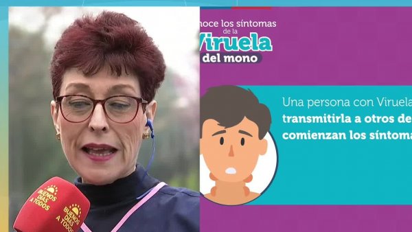 Alerta internacional por peligrosa "viruela del mono"
