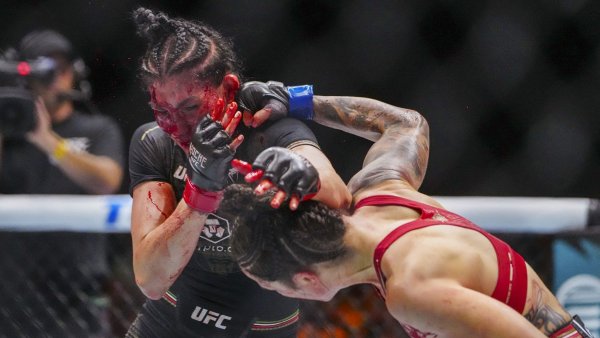 Imágenes sensibles: Peleadora de UFC queda con su rostro desfigurado tras combate
