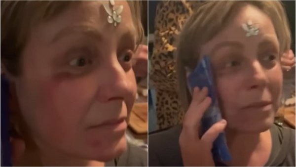 "Me tiré para salvarle la vida": Claudia Conserva revela accidente que sufrió en Fiestas Patrias
