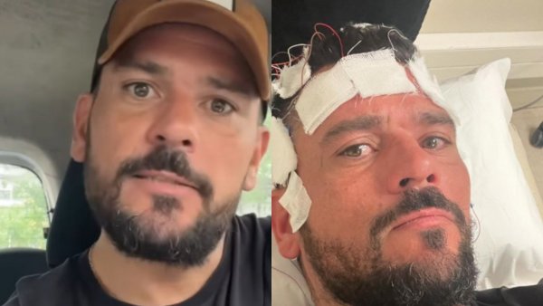 La indignación de Juan Pedro Verdier tras sufrir grave accidente: "Me transformaré en su peor pesadilla"
