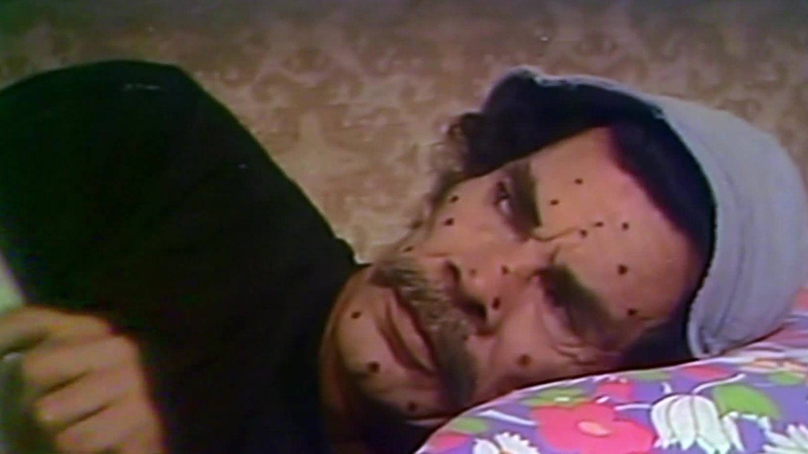 El Chavo del 8: La viruela
