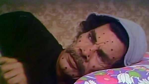 El Chavo del 8: La viruela
