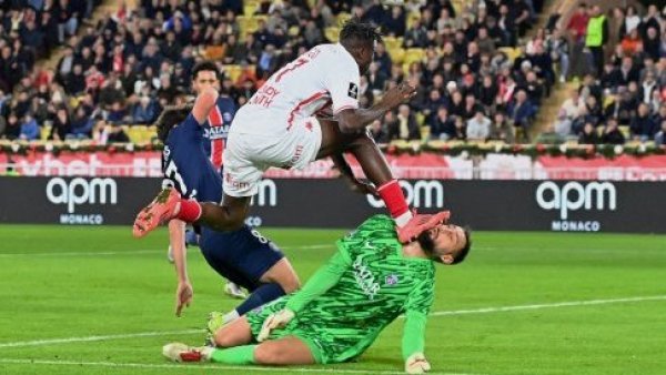 Parte del rostro de Gianluigi Donnarumma quedó irreconocible tras brutal pisotón
